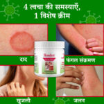 Rosden Malam – Ayurvedic Ointment for Itching, Skin Infection & Fast Relief - Image 2